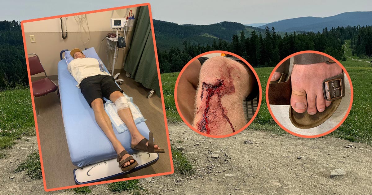 Mountain Bike Accident injury